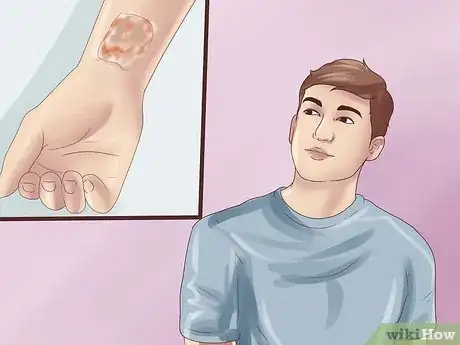 Imagen titulada Remove a Tattoo at Home With Salt Step 3