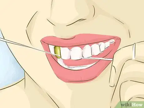 Imagen titulada Clean Gold Teeth Step 2