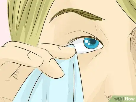 Imagen titulada Remove Something from Your Eye Step 7