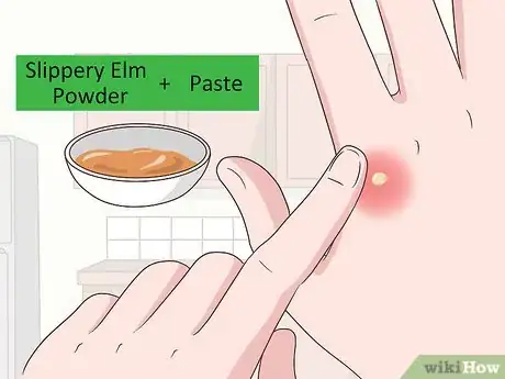 Imagen titulada Take Slippery Elm Powder Step 4