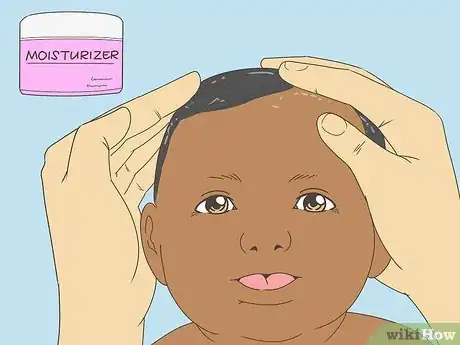 Imagen titulada Get Rid of Cradle Cap Step 7