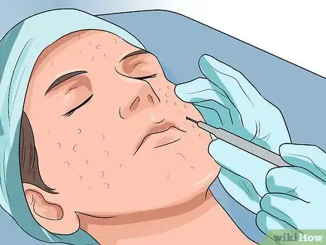 Imagen titulada Get Rid of Large Pores and Blemishes Step 17