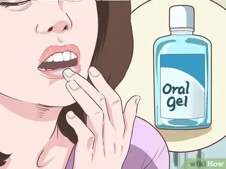 Imagen titulada Relieve Gum Pain Step 8