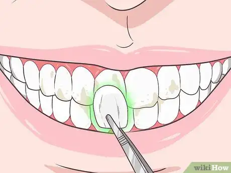 Imagen titulada Remove Brown Stains from Teeth Step 9