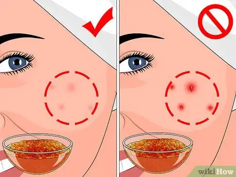 Imagen titulada Remove Dead Skin Using Sugar Step 9