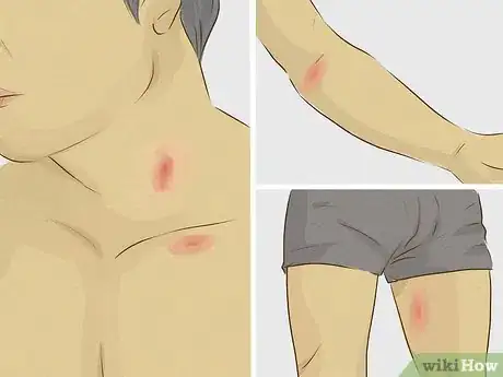 Imagen titulada Give Someone a Hickey Step 5