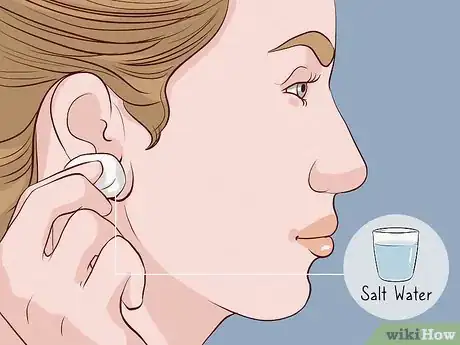 Imagen titulada Close an Earlobe Piercing Step 4