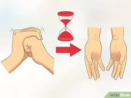 Imagen titulada Stop Cracking Your Knuckles Step 12