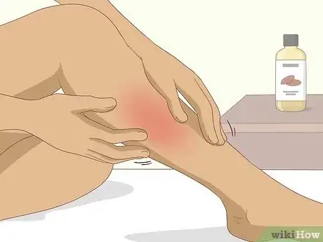 Imagen titulada Get Rid of Leg Pain Step 6