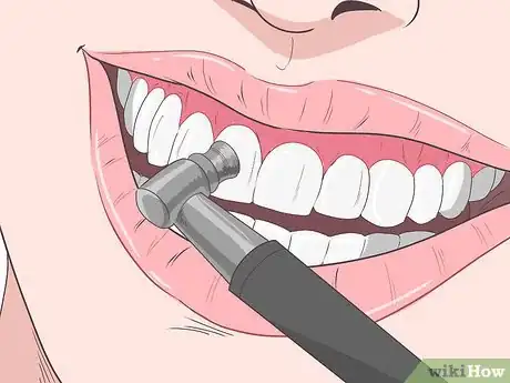 Imagen titulada Remove Brown Stains from Teeth Step 6