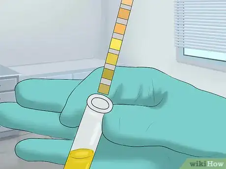 Imagen titulada Detect Blood in Urine Step 4