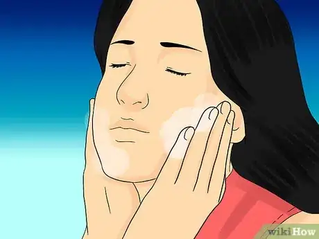 Imagen titulada Painlessly Pop a Pimple Step 3