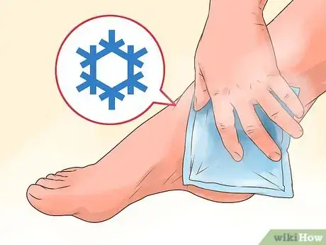 Imagen titulada Cure a Swollen Ankle Step 14