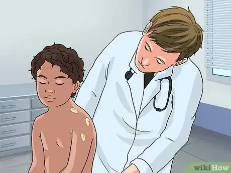 Imagen titulada Treat Ringworm in Kids Step 4