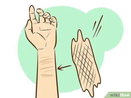 Imagen titulada Get Rid of Self Harm Scars Step 6