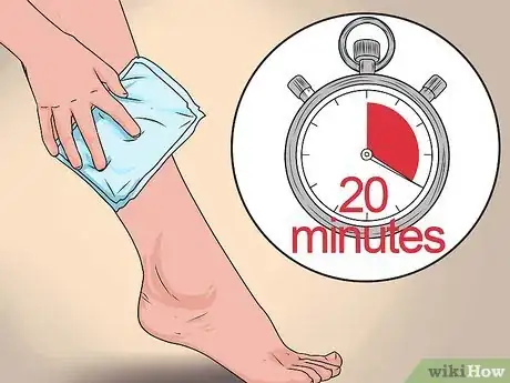 Imagen titulada Treat a Torn Calf Muscle Step 9