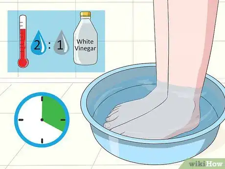 Imagen titulada Treat Toe Nail Fungus Step 4