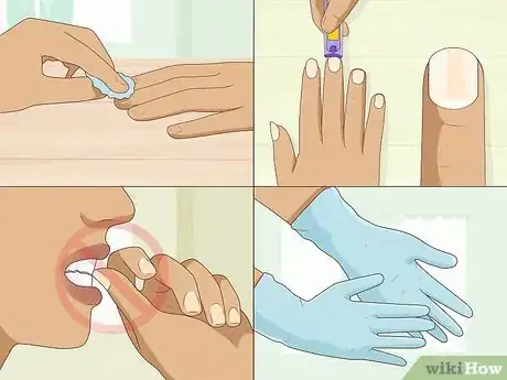 Imagen titulada Stop Itchy Cuticles Step 7