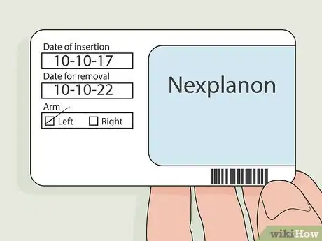 Imagen titulada Remove Nexplanon Step 1