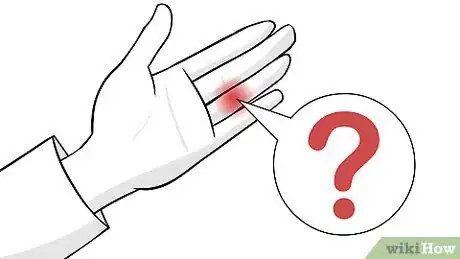 Imagen titulada Treat a Jammed Finger Step 1