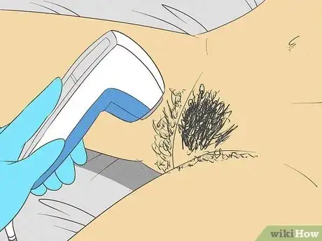 Imagen titulada Prevent Ingrown Hairs on the Pubic Area Step 10