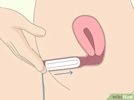 Imagen titulada Insert a Tampon Without Applicator Step 7