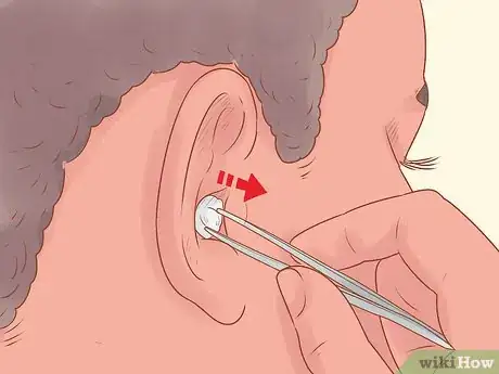 Imagen titulada Remove Something Stuck in a Child's Ear Step 3