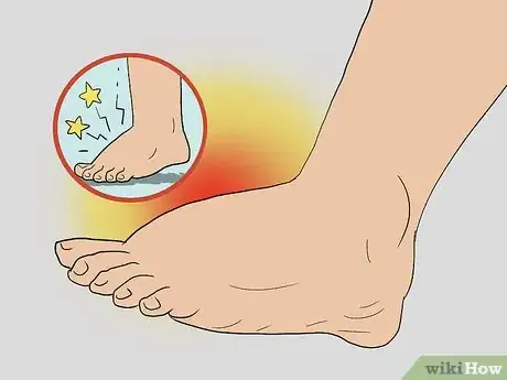 Imagen titulada Treat Pain at the Top of the Foot Step 4