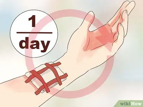 Imagen titulada Treat a Wound Created by an Impaled Object Step 14