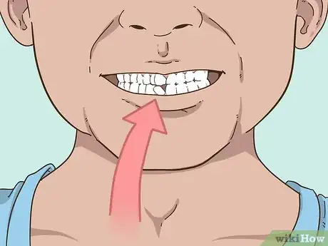 Imagen titulada Painlessly Pull Out a Loose Baby Tooth Step 1