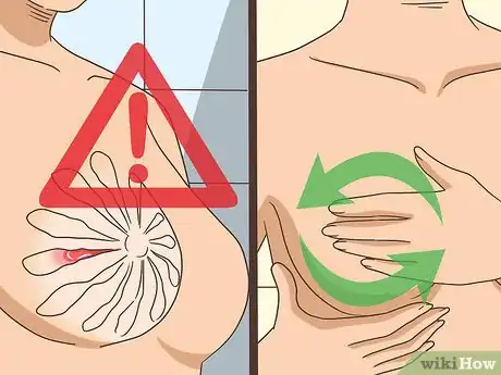 Imagen titulada Stop Breastfeeding Without Pain Step 10