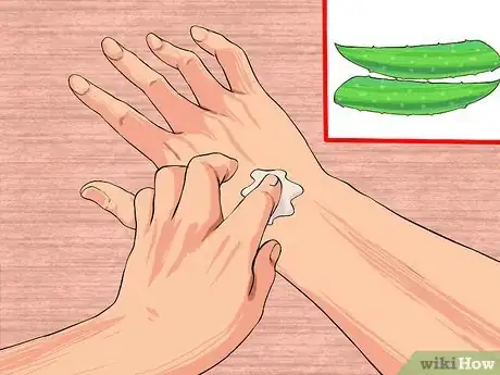 Imagen titulada Use Aloe Vera to Treat Rheumatoid Arthritis Step 3