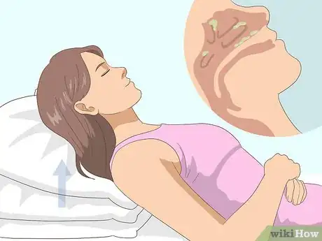 Imagen titulada Stop Coughing in 5 Minutes Step 5