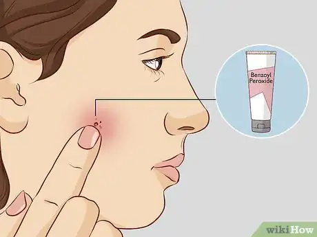 Imagen titulada Take Care of Your Face (Females) Step 11
