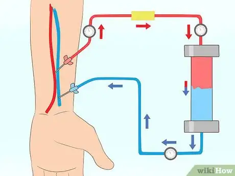 Imagen titulada Bring Down High Creatinine Levels Step 20