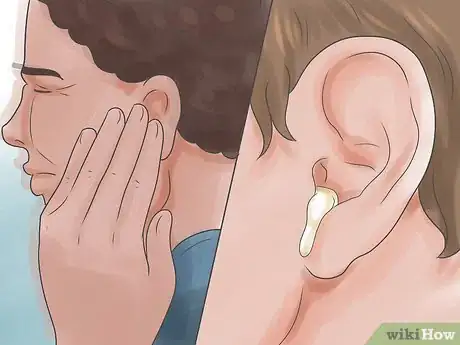 Imagen titulada Cure an Ear Infection Step 5