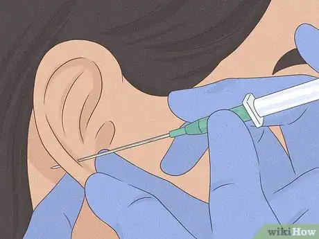 Imagen titulada Clean a New Ear Piercing Step 5