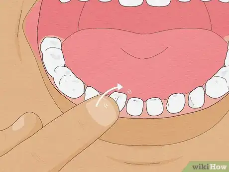 Imagen titulada Pull a Loose Tooth at Home Step 1