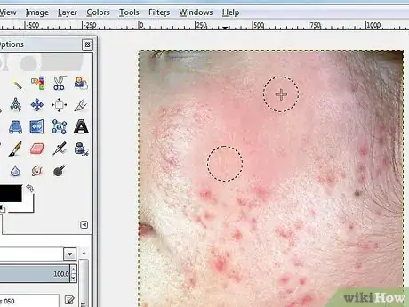 Imagen titulada Remove Facial Blemishes on GIMP Step 4