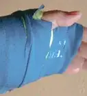 hacer un yeso falso para tu brazo