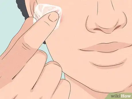 Imagen titulada Get Rid of a Zit Overnight Step 8