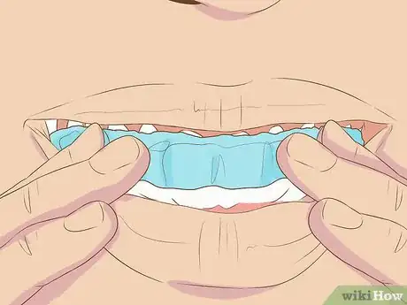 Imagen titulada Make Fake Braces or a Fake Retainer Step 15