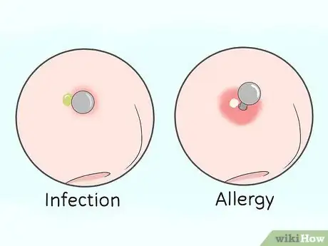 Imagen titulada Heal a Nose Ring and Take Care of Infections Step 6