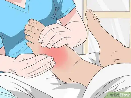 Imagen titulada Treat Swelling Step 11