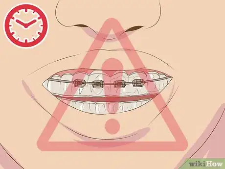 Imagen titulada Make Fake Braces or a Fake Retainer Step 19