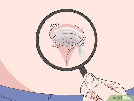 Imagen titulada Treat an Infection in Your Belly Button Step 1