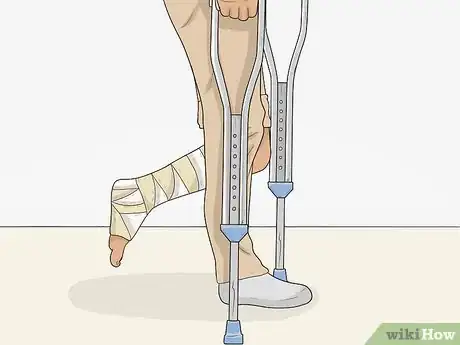 Imagen titulada Go Upstairs with Crutches Step 1