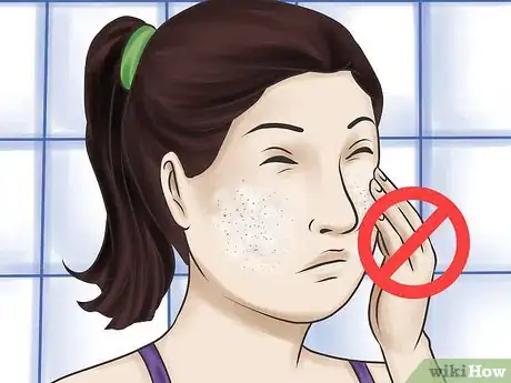 Imagen titulada Use Aloe Vera for Acne Step 11