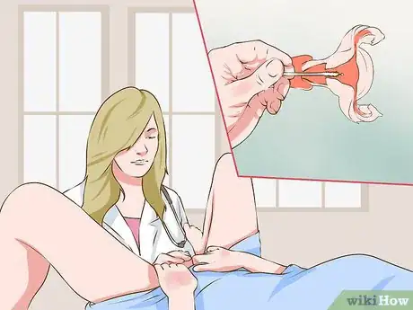 Imagen titulada Get an IUD Taken Out Step 7