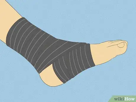 Imagen titulada Treat a Broken Ankle Step 10